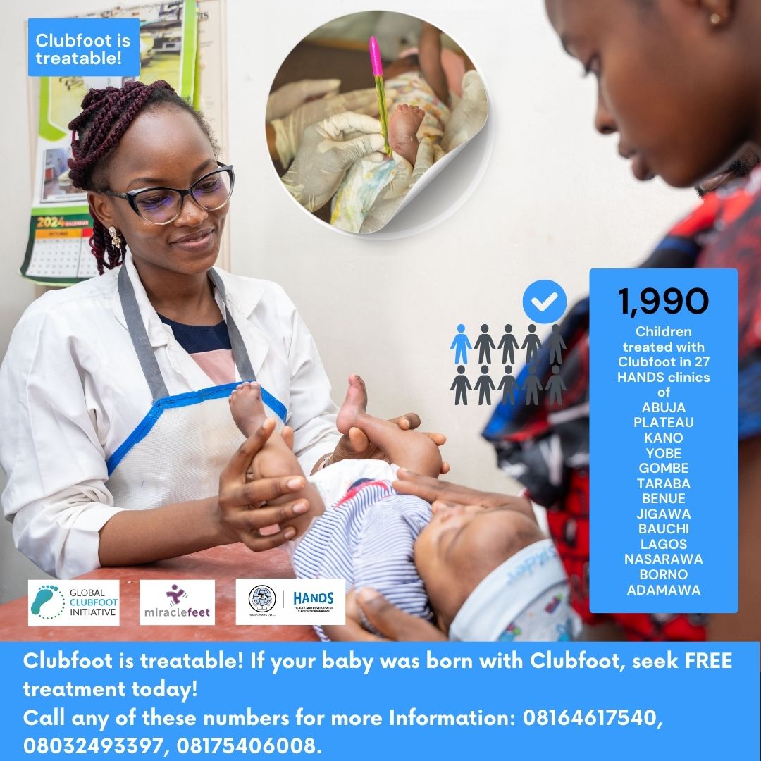 Transforming Lives, One Step at a Time, Through the Clubfoot Programme. 